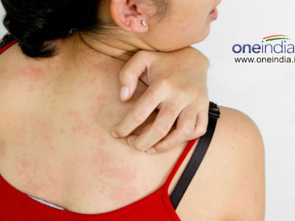 Dấu hiệu tố cáo cơ thể bạn đang thiếu hụt Vitamin trầm trọng
3