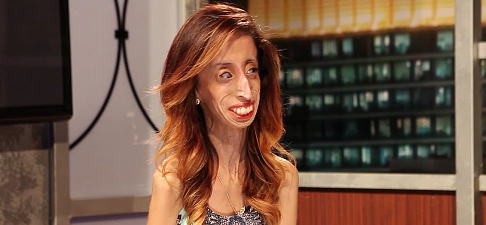 21 câu nói truyền cảm hứng từ “cô gái xấu xí nhất thế giới” Lizzie Velasquez và bằng chứng cho một vẻ đẹp chân chính
0