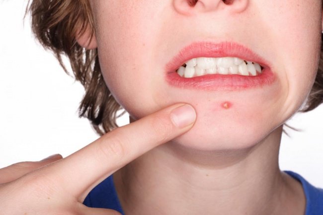10 công dụng tuyệt vời của thuốc Aspirin có thể bạn chưa biết
0