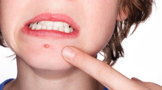 13 công dụng tuyệt vời của GIẤM có thể bạn chưa biết
8