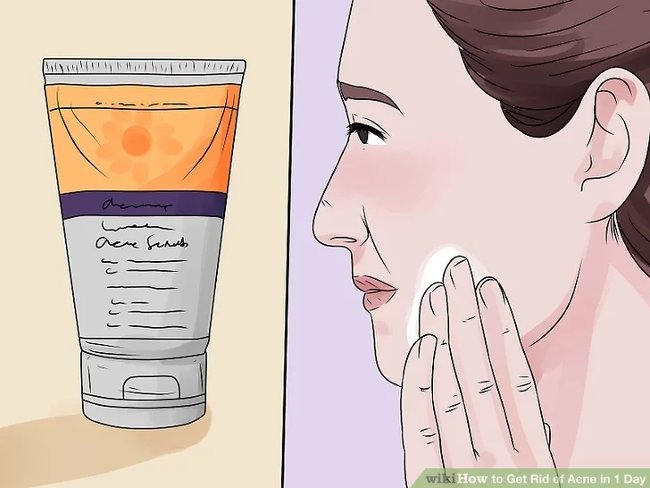 
                        Cách loại bỏ mụn trứng cá hiệu quả chỉ trong 1 ngày
                     1