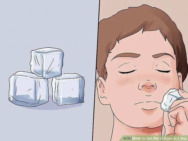 
                        Cách loại bỏ mụn trứng cá hiệu quả chỉ trong 1 ngày
                     7