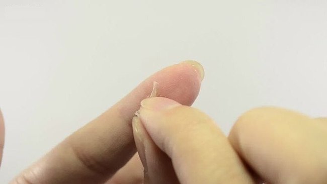 Tẩy vết keo 502 dính trên da vô cùng đơn giản
9
