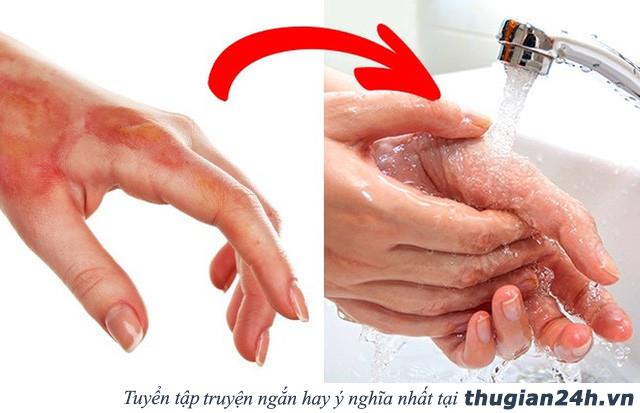 6 nhầm lẫn ngớ ngẩn mà nhiều người vẫn thực hiện khi xử lý vết thương khiến bệnh càng nặng thêm 1